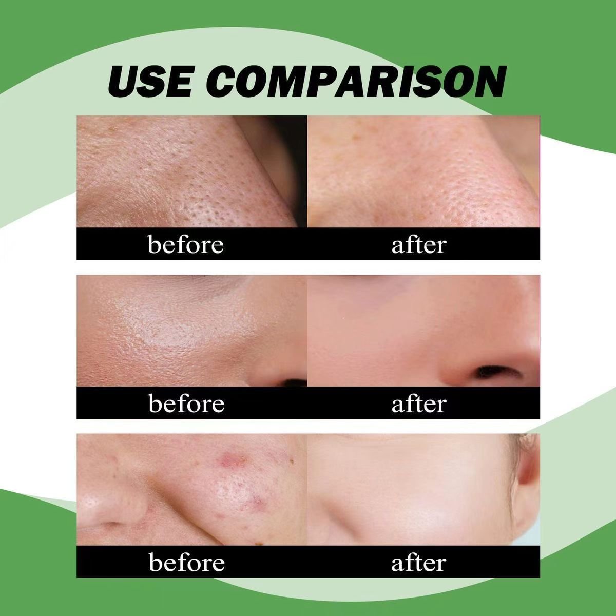 3 African Black Soap - Image 3