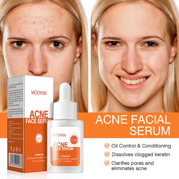 Midnight Rescue Acne Essence | AHAs + Salicylic Acid Serum • Oil Control + Scar Fading