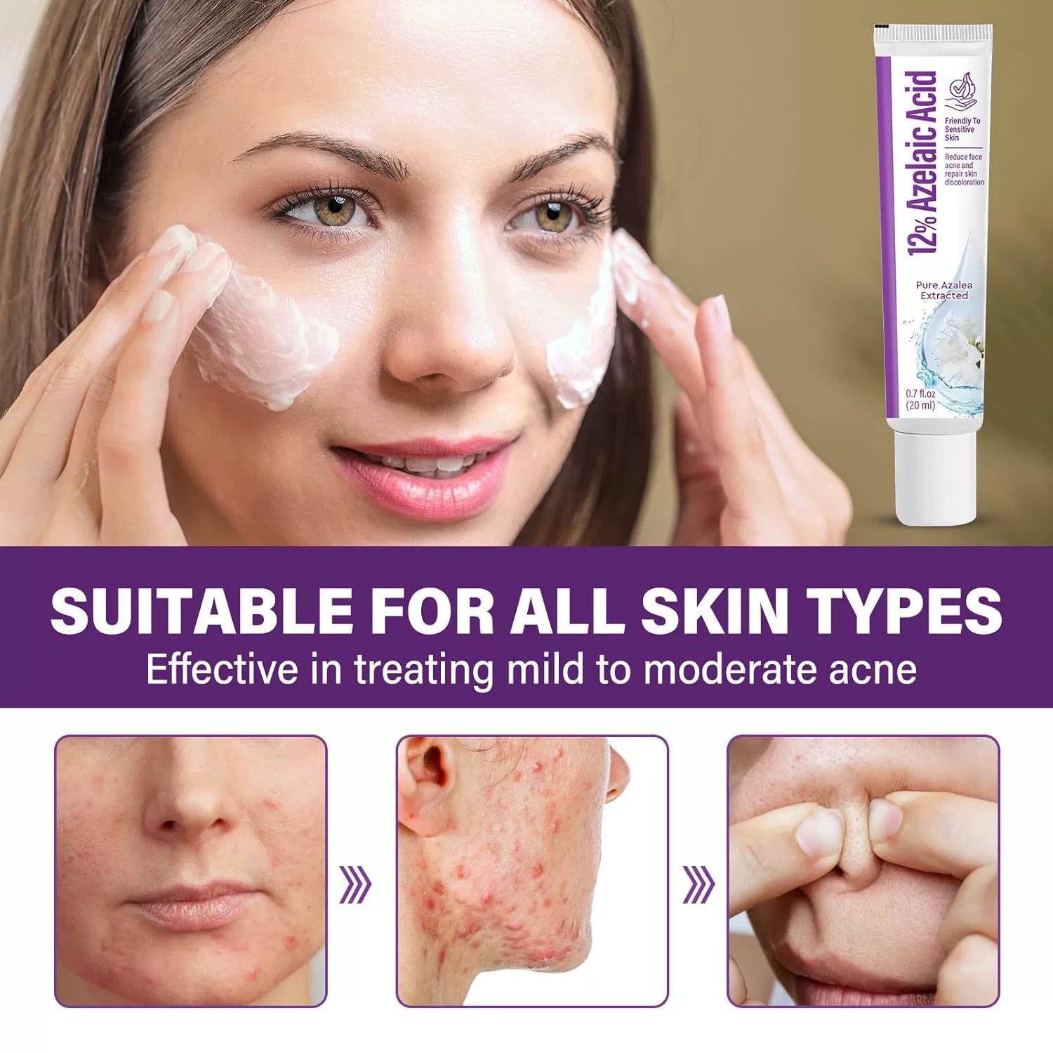 主图-5 Azelaic Acid 12% Clarifying Essence Closed Comedones • Blackheads • Acne • Hydration Booster - Image 5