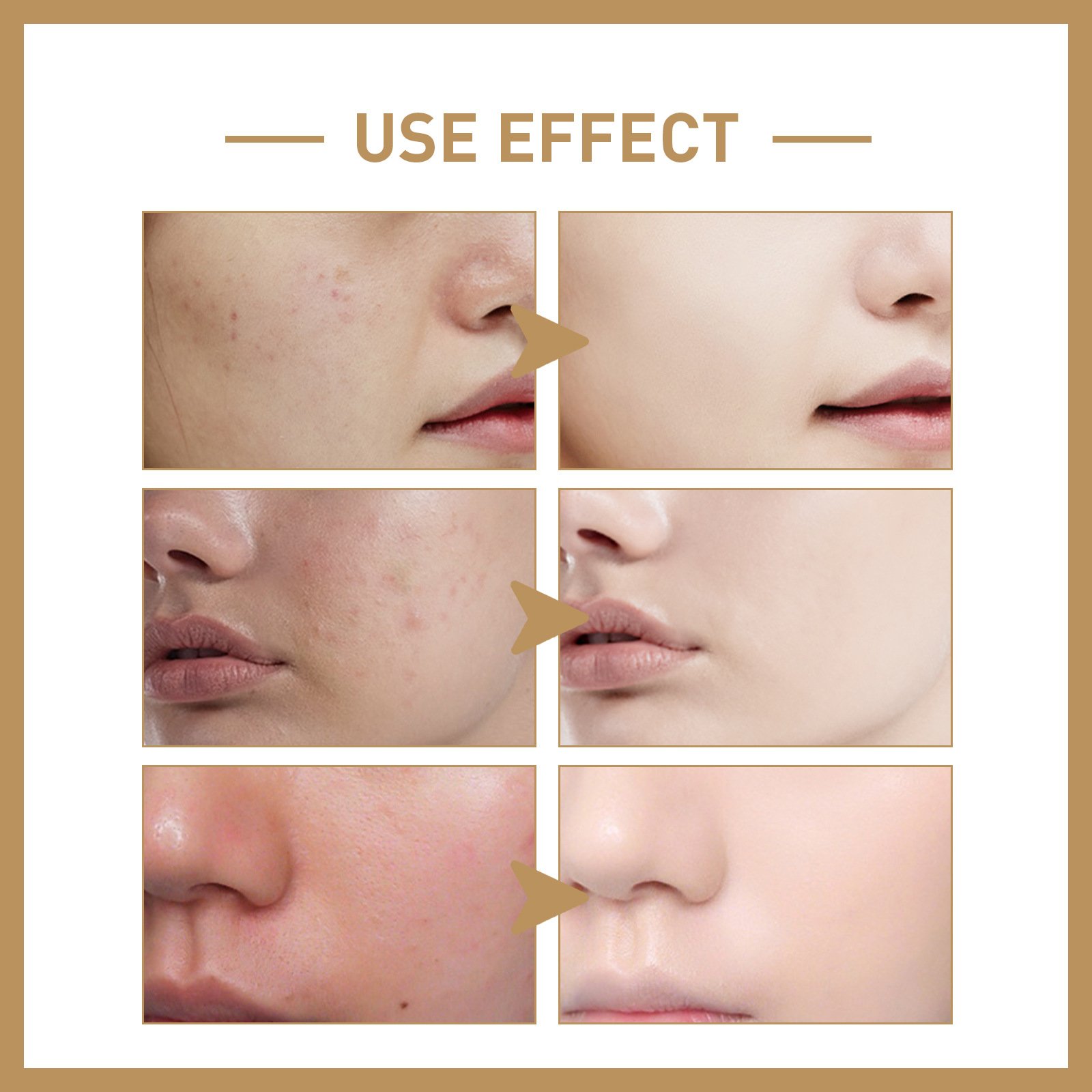 eelhoe rice toner – deep hydration & skin barrier care eelhoe rice toner – deep hydration & skin barrier care