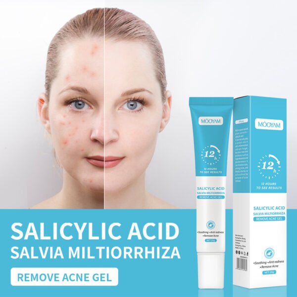Mooyam Salicylic Acid Acne Cream