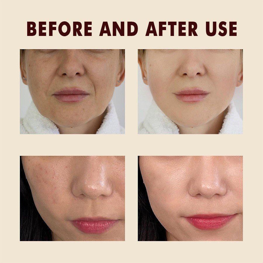 主图-4 Dr. Melaxin Black Rice Ampoule – Soft Exfoliating & Blackhead Remover - Image 5