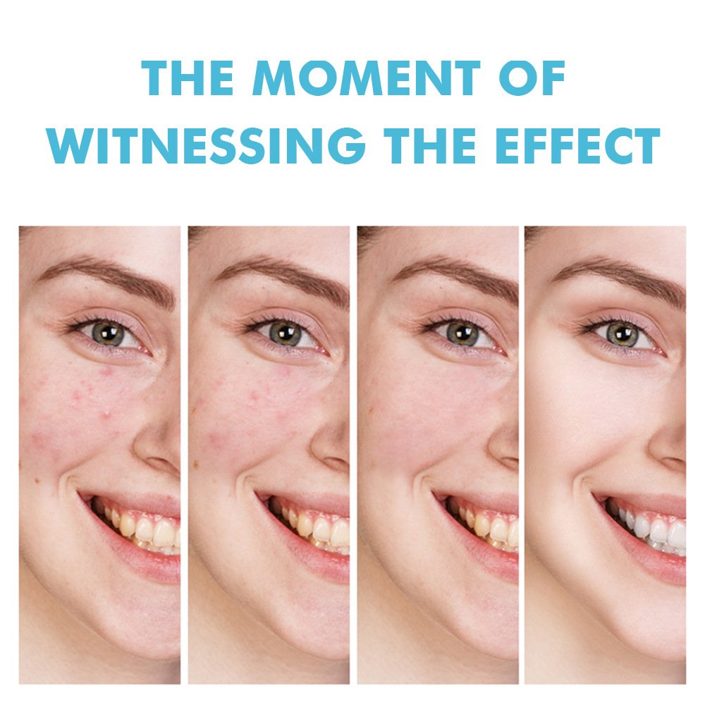 mooyam salicylic acid acne cream mooyam salicylic acid acne cream