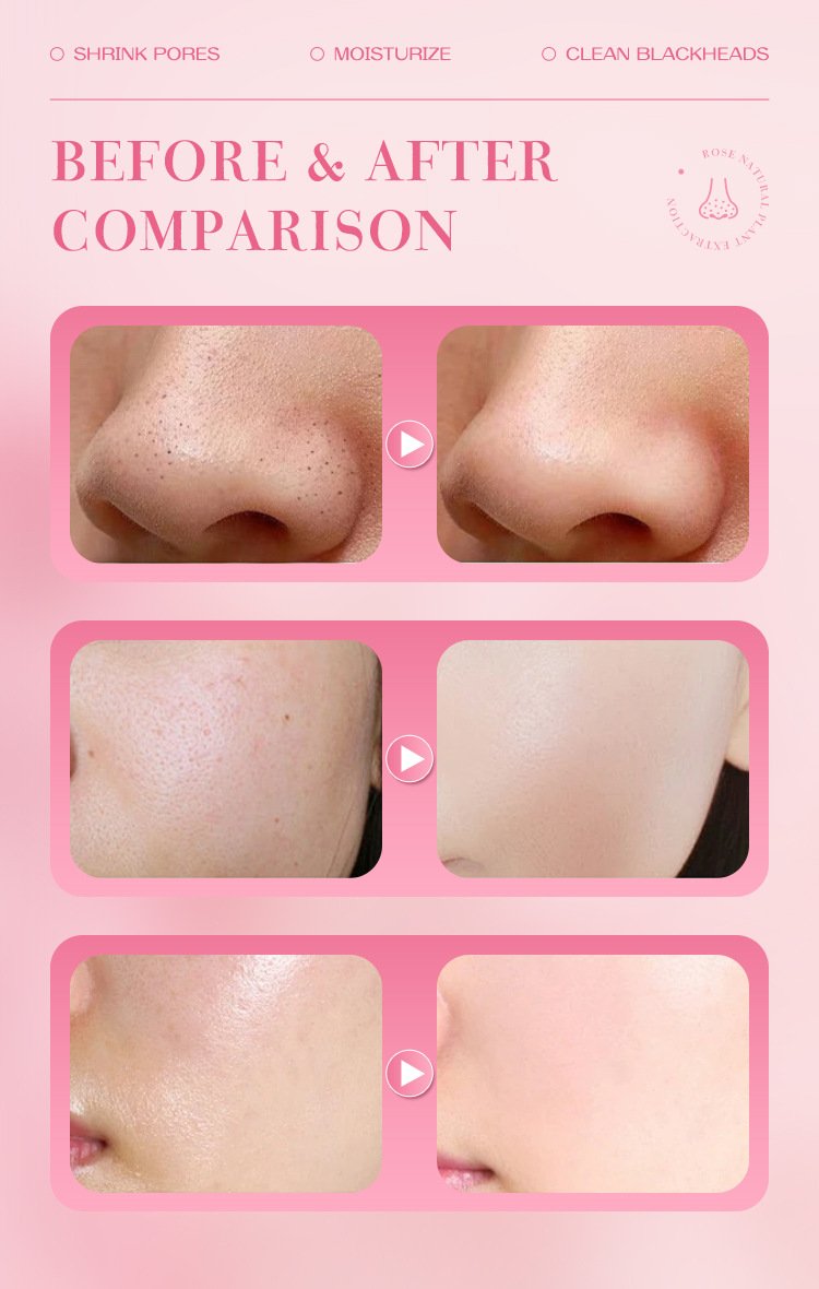 详情-10 Mooyam Rose Exfoliating Gel - Image 11