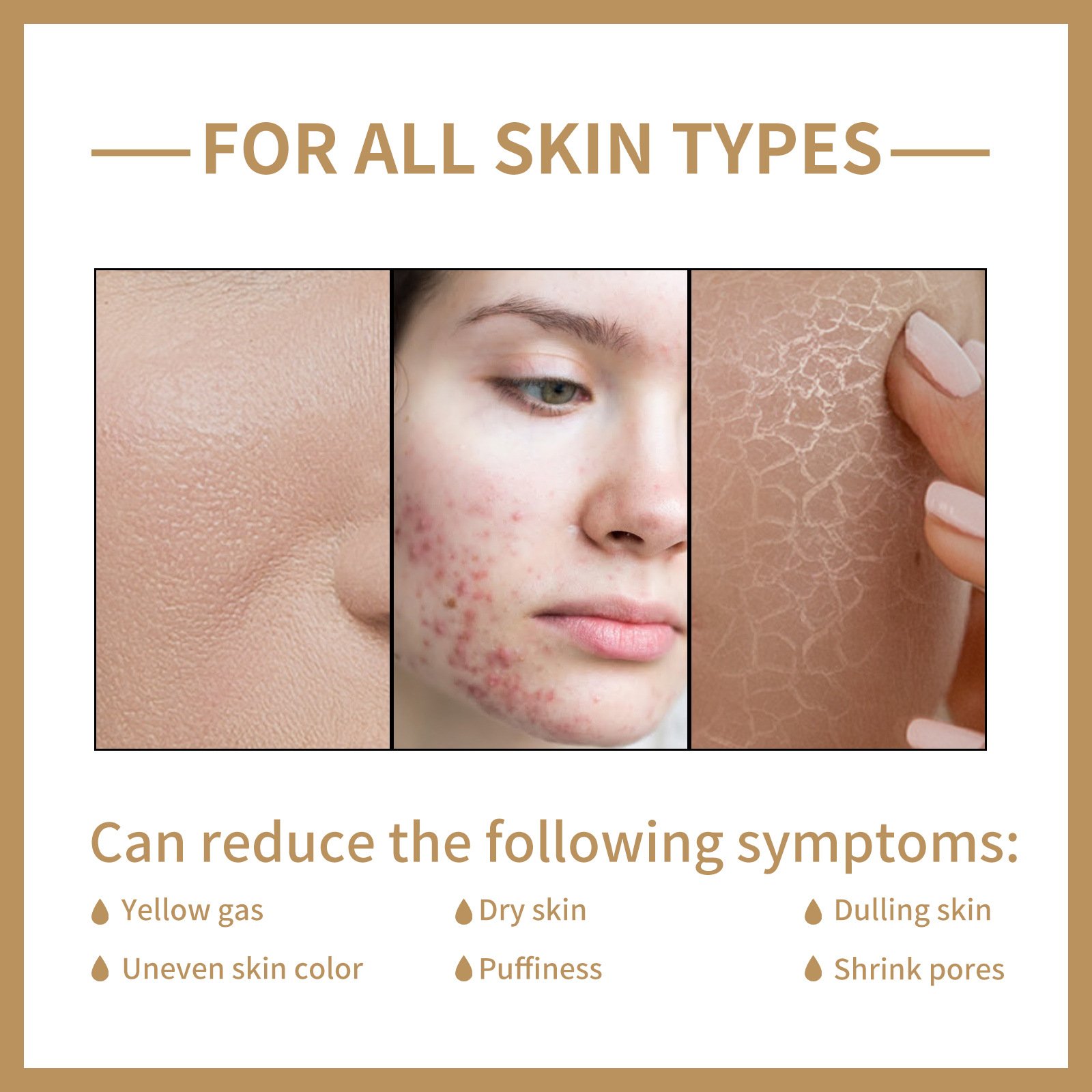 eelhoe rice toner – deep hydration & skin barrier care eelhoe rice toner – deep hydration & skin barrier care