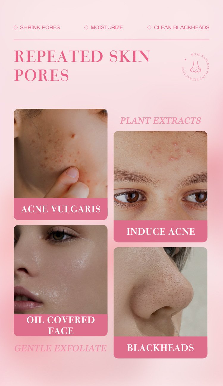 详情-4 Mooyam Rose Exfoliating Gel - Image 9