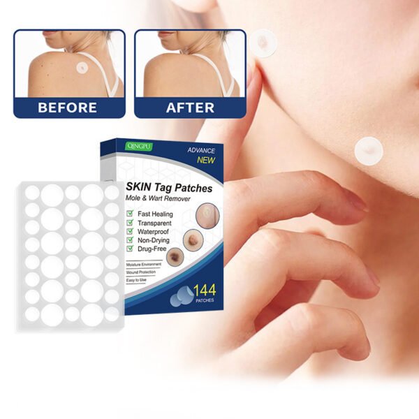 Invisible Acne Patch – Clear Skin, Anytime Anywhere