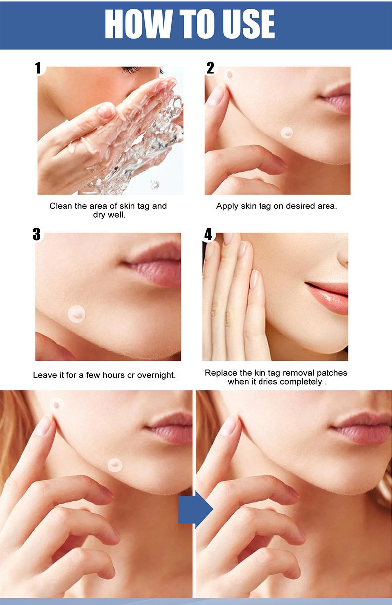 invisible acne patch – clear skin, anytime anywhere invisible acne patch – clear skin, anytime anywhere