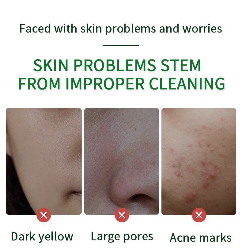 skat hy! amino ac tack anti acne facial wash skat hy! amino ac tack anti acne facial wash