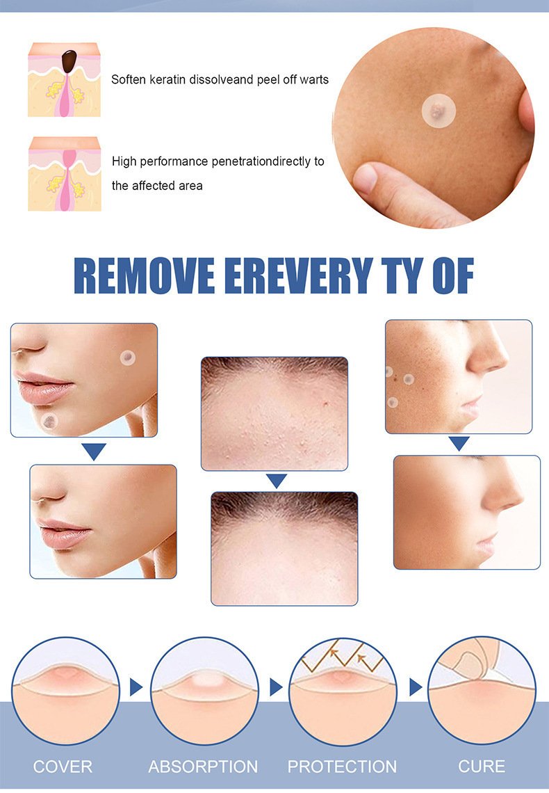 invisible acne patch – clear skin, anytime anywhere invisible acne patch – clear skin, anytime anywhere
