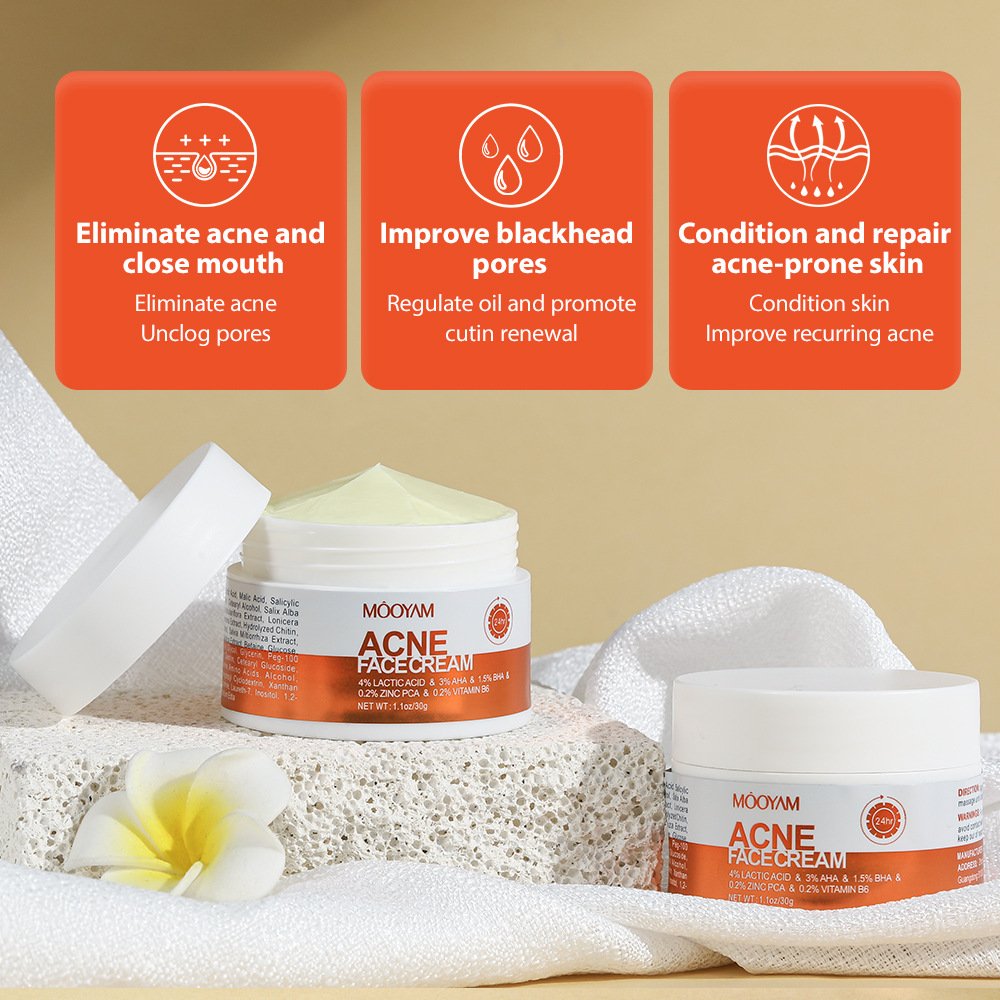 mooyam acne face cream mooyam acne face cream