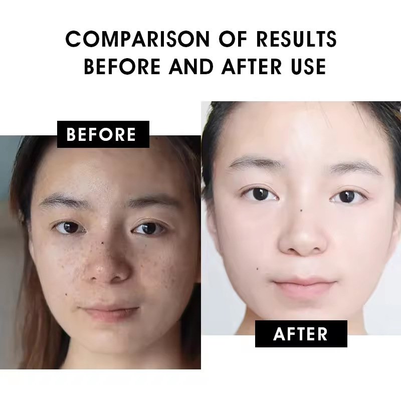 carvenchy vitamin c facial serum – glow boost & deep hydration formula carvenchy vitamin c facial serum – glow boost & deep hydration formula