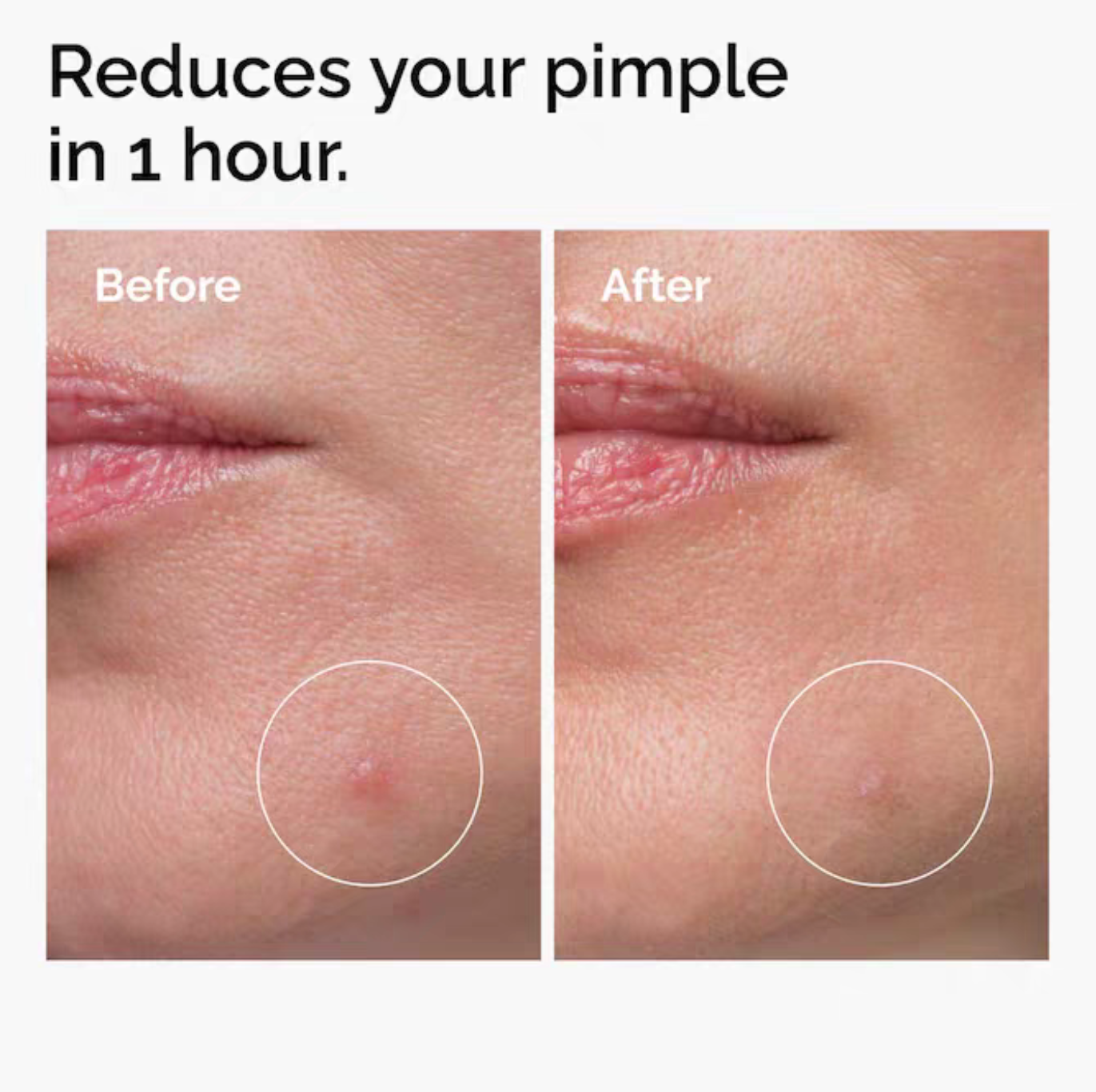the ordinary sulfur 10% powder to cream concentrate | targeted acne spot treatment the ordinary sulfur 10% powder to cream concentrate | targeted acne spot treatment